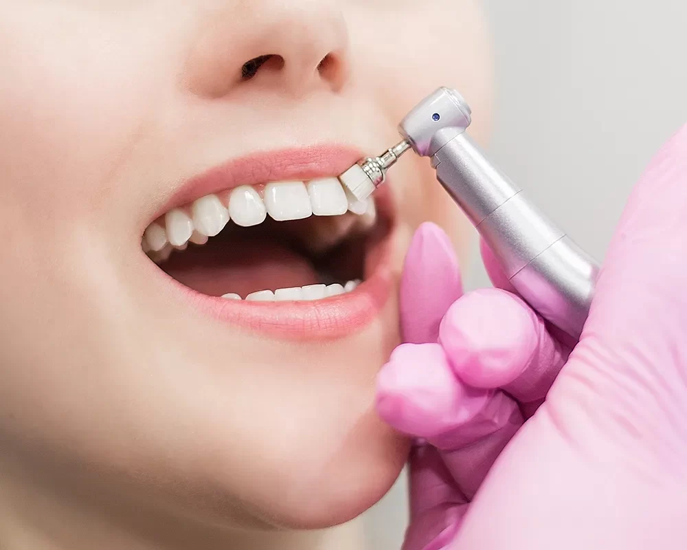 dental cleaning in toronto