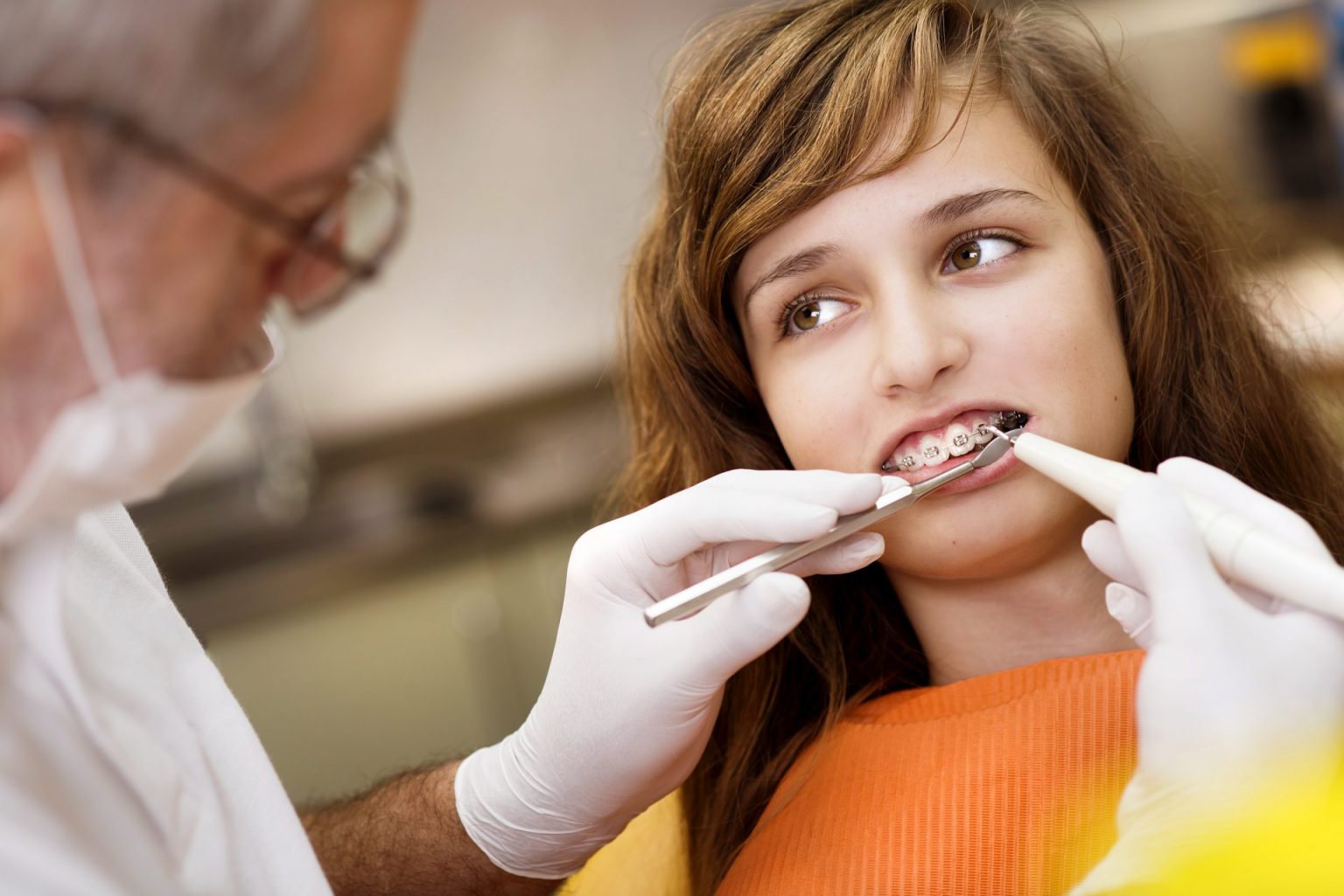 what to expect at your dental cleaning when you have braces