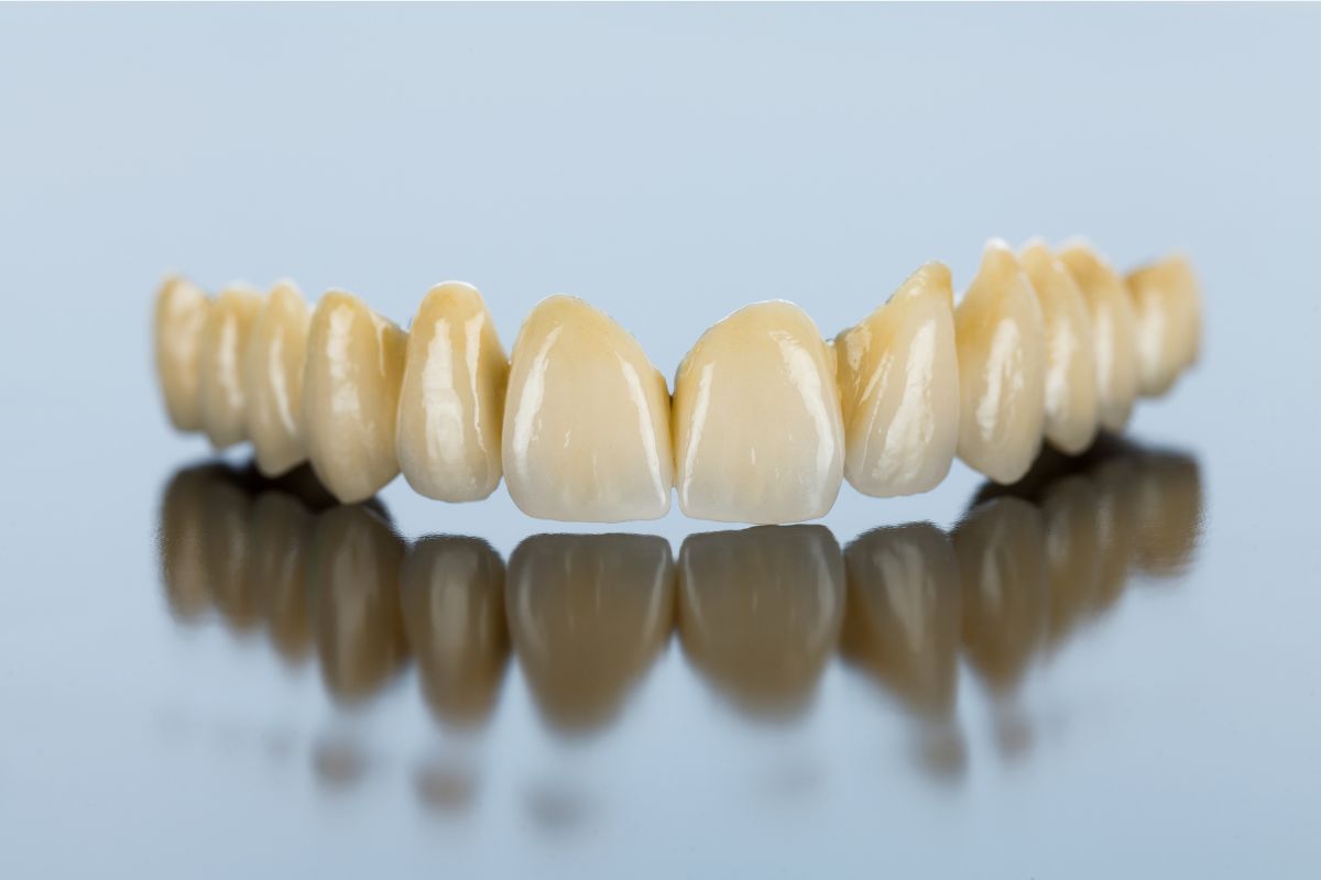 which type of dental bridge is right for comfort and fit?