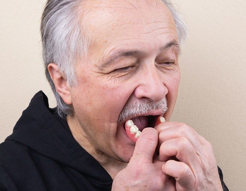 Dentures