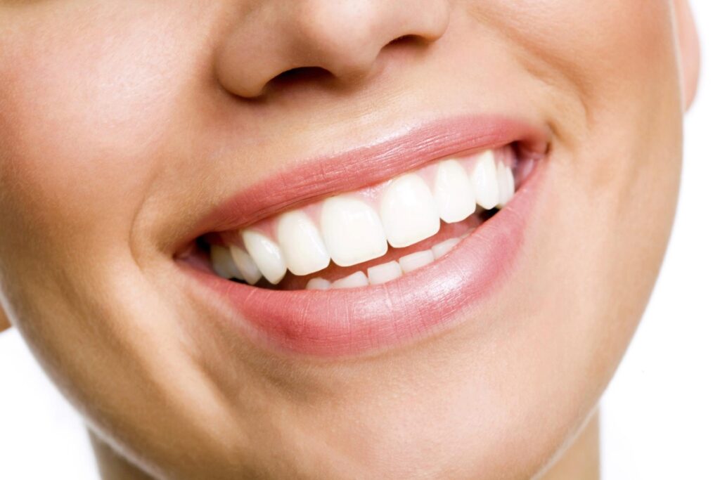 Lo Teeth Pro Teeth Whitening vs Kits: What Works Best? | Dentist in Toronto